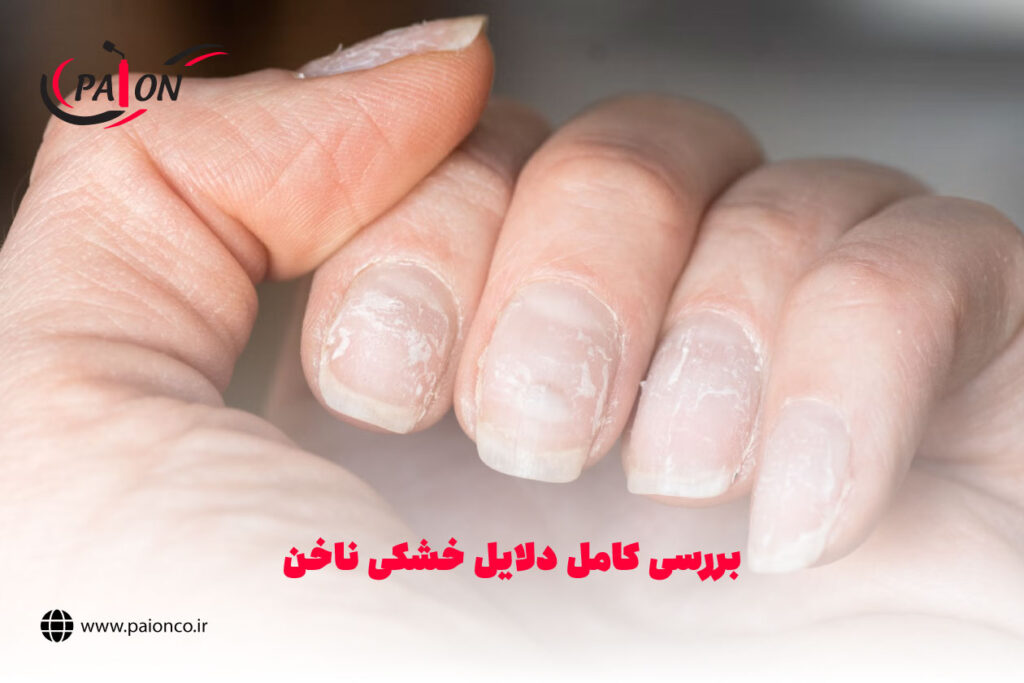 خشکی ناخن